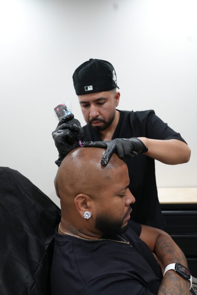 SMP, Scalp Micropigmentation, hair restoration, Las Vegas.